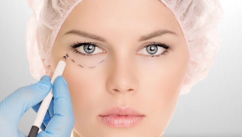 GÖZ KAPAĞI OPERASYONLARINDAN SONRAKİ SÜREÇ NASILDIR?