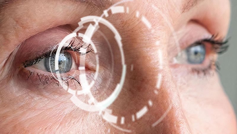 Akıllı mercek ( trifocal mercek) sonrası ne zaman net görüş sağlanır?