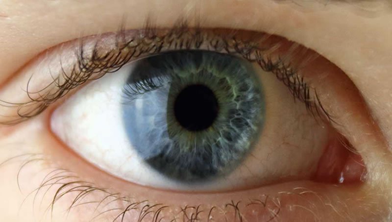 Göz içine merceği nasıl yerleştiriyoruz?
