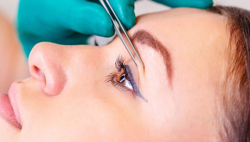 GÖZ KAPAĞI ESTETİĞİ SONRASINDA NORMAL YAŞANTIMIZA NE ZAMAN DÖNEBİLİRİZ?