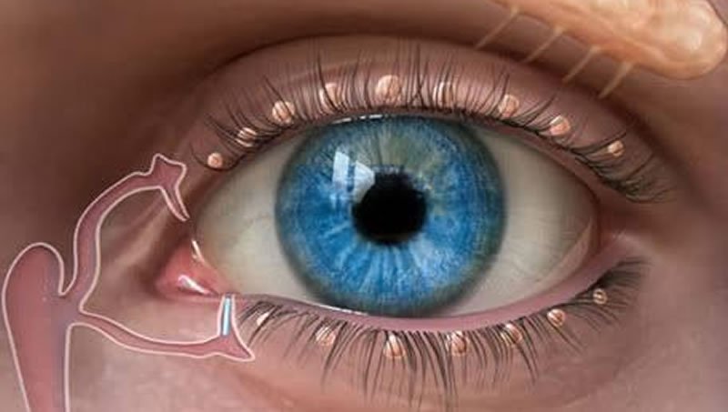 GÖZYAŞI BEZİ SARKMASI YA DA FITIKLAŞMASI NEDİR?